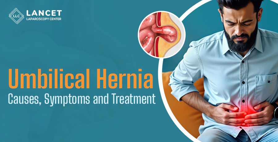 Umbilical Hernia Causes, Symptoms and Treatment | Lancet Laparoscopy Center | Vizag