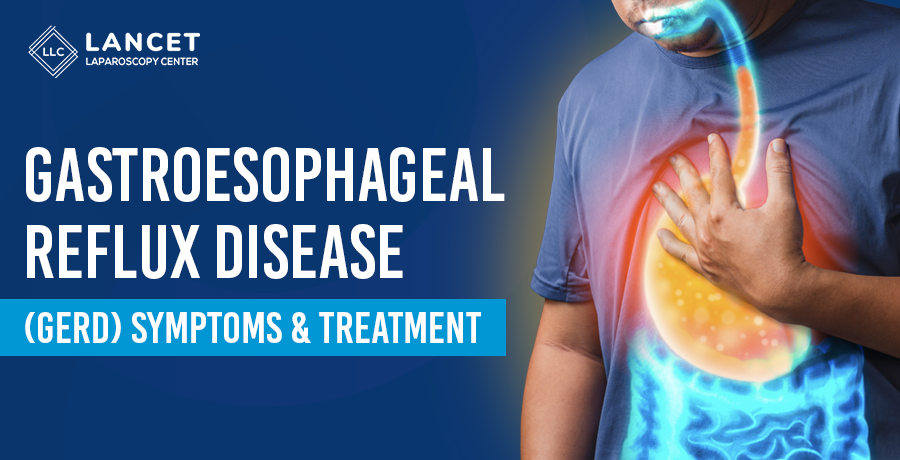 GERD Treatment in Vizag | Dr Ramesh Baipalli