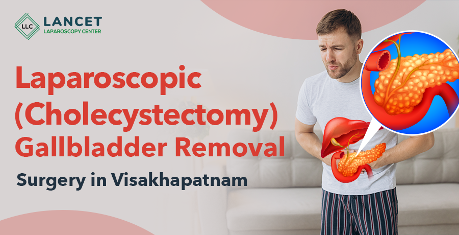 Laparoscopic Cholecystectomy Treatment in Vizag